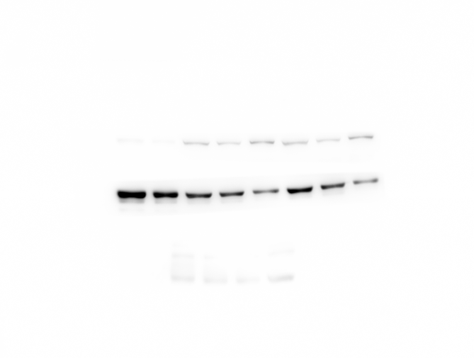 Western Blot 成像效果